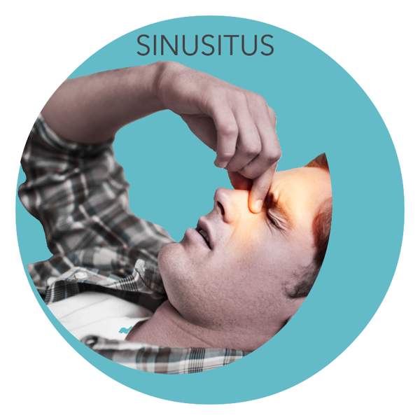 sinus